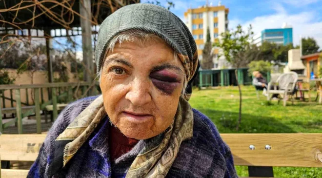 Antalya’da Zihinsel Engelli Kadın Diyaliz Merkezinde Yaralandı